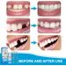 Buy Temporary Dental Replacement Products | Denture Sets Adhesives & DIY Vampire Fake Dentures - International Shipping - Buy Online on GoSupps.com