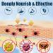 Extra Strength Toe Nail Repair Treatment for Thick, Cracked, Damaged, Discolored Yellow Nails - 30ml - Buy Online on GoSupps.com