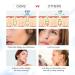 Blackhead Remover Pore Vacuum - Upgraded Electric Cleaner with 5 Adjustable Suction Power - USB Rechargeable Pore Vacuum Removal Tool for Blackhead and Whitehead (White) - Buy Online on GoSupps.com
