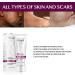 Stretch Mark & Scar Removal Cream (40g) - Effective Skin Repair Solution - Buy Online on GoSupps.com