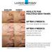 La Roche Posay Glycolic Acid Serum with Kojic Acid and Vitamin B5 | Dark Spot Corrector & Skin Tone Brightener - Buy Online on GoSupps.com