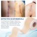 Silicone Paving for Scars | C-Section Burn & Keloid Treatment | Free Silicone Rag Roller (4cm x 330cm) - Buy Online on GoSupps.com