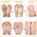 Foot Mask - 5 Pairs Aloe Vera Peeling Mask & Moisturizing Socks for Dry Cracked Feet | Foot Spa for Men & Women - Buy Online on GoSupps.com