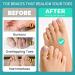 Soft Gel Toe Spacers - Correct Overlapping and Bent Toes - Toe Separator for Men and Women - Buy Online on GoSupps.com