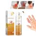 Cvreoz Bienengift Spray against warts 30ml cvreoz beeergift warts spray cvreoz beeergift warts and key removal treatment spray 1 piece cvreoz beeergift against spray