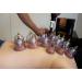 ASCLE 12-Cup Cupping Set with Extra Thick Super Cups | Premium Quality - Buy Online on GoSupps.com