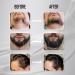 Derma Roller Kit for Face, Body, Hair & Beard Growth - 3 Pack Titanium Microneedle Rollers for Home Use - Micro Needling Dermaroller for Men & Women - Buy Online on GoSupps.com