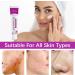 Azelaic Acid 12% Serum with Niacinamide & Hyaluronic Acid - Helps Improve Skin Texture, Reduce Redness, Smoothing Skin and Blemish, Premium Azelaic Acid Facial Cream for Sensitive Skin (1PC) - Buy Online on GoSupps.com