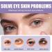 Black Medlar Eye Cream Firming Eye Cream Anti Aging Korean Eye Cream For Dark Circles And Puffy Eyes Diminishing Deep Wrinkles Under Eye Cream Hydrating Eye Cream For Men And Women 30ml - Buy Online on GoSupps.com