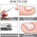 52 Pcs Ingrown Toenail Correction Strips Brace Kit Ingrown Toenail Corrector Toenail Correction Patches Ingrown Toenail Treatment Toenail Straightener Strips with Nail Clipper for Women Men Foot Care - Buy Online on GoSupps.com