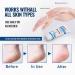 Urea Foot Cream 40 Percent - Cracked Heel Repair Cream For Feet and Hand - Athletes Foot Cream for Very Dry Feet - Foot Moisturiser - Foot Care Cream - Skin Care Cream for Hand Foot and Body 85g - Buy Online on GoSupps.com