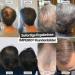 Imperio Scatter Hair - 100% Natural Dark Blonde Hair Compression for Full Look in Seconds | Premium Quality Purple Hair - Buy Online on GoSupps.com