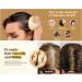 Ce coffret d'huile capillaire bio base de romarin et d'huile de ricin associ un masseur de cuir chevelu am liore efficacement les probl mes de poils incarn s et de chute de cheveux - Buy Online on GoSupps.com