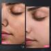 Bubble Carbonated Clay Mask | Deep Cleansing Blackhead Removal Exfoliation & Pore Detox | International Shipping - Buy Online on GoSupps.com