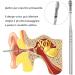 6 Stainless Steel Ear Wax Removal Tools - Ear Cleaning Set for Adults & Kids with Storage Box (Black) - Buy Online on GoSupps.com