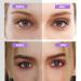 336pcs Single Side Eyelid Tape Stickers - Medical-use Fiber Eyelid Lift Strips for Hooded, Droopy, Uneven, or Mono-eyelids - Buy Online on GoSupps.com