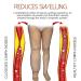 Mediginger Antiswelling Lymphunclog Ointment 60g - Suitable for All Skin Types - Buy Online on GoSupps.com