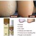 Fun_Gus Combat Foot Spray - Herbal Anti-Fungal Solution for Foot Odor Infections and Beriberi - 2-Pack - Buy Online on GoSupps.com