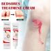 Pressure Soress Relief Cream 20g Bedsore Ointment Bed Soress Care Cream Fast Healing Soress Relief Healing Cream For Chafed Skin Hard-to-Heal Skin Soress Soothing Relief - Buy Online on GoSupps.com