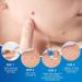 Skin Tag Remover Cream Wart Removal Cream Skin Tag Remover for Face & Hands & Body Wart Removal for Hands and Body Skin Tag Remove with Natural Ingredients Easy Use at Home 20 g - Buy Online on GoSupps.com