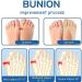 5/10 Pairs Orthoes Bunion Relief Socks for Women | Projoint Anti-Bunion Health Socks | Align Toe Compression Socks | Five Finger Support (5 Pairs) - Buy Online on GoSupps.com