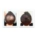 Dark Brown Hair Loss Concealer Trial Size - Cover Bald Spots Instantly - 10-Day Supply - All-Natural Fiber Formula - Buy Online on GoSupps.com