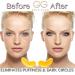 Gold Glow Under Eye Patches - 24K Gold Masks for Dark Circles & Puffiness with Collagen, Hyaluronic Acid, Vitamin C - 30-Pairs - Buy Online on GoSupps.com