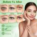 Aloe Vera Eye Pads 60 PCS - Anti-Aging, Soothing, Hydrating & Moisturizing Under Eye Patches - Buy Online on GoSupps.com