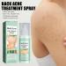 Back Acne Spray - 2% Salicylic Acid & Tea Tree Oil Treatment for Clear Skin | Effective Back & Body Acne Solution for Men & Women - Buy Online on GoSupps.com