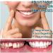 Adjustable Snap-On Prostheses & Artificial Teeth for Men & Women | 3-Piece Veneers for a Confident Smile - Buy Online on GoSupps.com