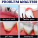 Toothache Relieving Spray Toothache Pain Relief for Adult Oral Care Spray Dental Pain Relief Pain Spray for Toothache Relief Pain Relief for Toothache Gum Pain Spray Effective Toothache Remedy Spray - Buy Online on GoSupps.com