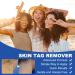 Skin Tag Tool For Small to Large Skin Tags 1-9mm Painless Skin Tag Removal Kit Tools with 60 Removal Bands And 36 Repair Patches & 20 pcs Cleansing Wipes Easy to Use - Buy Online on GoSupps.com
