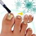 2 IN 1 Fungal Nail Treatment Nail Repair Essence For Toenails Anti Fungal Nail Treatment Toenail Fungus Treatment Nail Fungus Serum For Toenail Nail Fungal Treatment Extra Strength Fast Nail Repair - Buy Online on GoSupps.com