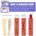 HADAVAKA Vein Care Fading Cream Varicose Vein Cream Leg Swelling Earthworm Leg Care Improve Blood Circulation Relieve Pain of Legs 2 - Buy Online on GoSupps.com