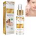Milia Remover Milia Removal Spot Care Milia Spot Serum for Face Milia Spot Remover Milia Treatment Spot Remover for Face Helps Dissolve and Reduce Milia Nourish Skin Care