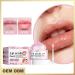 Lip Scrubs Exfoliator Moisturizer Kit - 2PC Set for Smoother, Hydrated Lips - Buy Online on GoSupps.com
