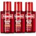 Alpecin Double Effet 3 x 200 ml Men's anti-dandruff shampoo | Anti-hair loss shampoo for men | Oily hair shampoo | Hair baldness treatment