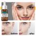 Caffeine Solution 30ml Antioxidant Face Serum for Women High Firming Skin Serum Hyaluronic Acid Serum for Face Relieve Redness & Promote Skin Collagen Niacinamide Serum for Face Fade Puffiness on Face - Buy Online on GoSupps.com