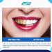 Dr. Nick's White & Healthy Professional Teeth Whitening Strips - 20 Treatments, Dentist Formulated for Sensitive Teeth - Buy Online on GoSupps.com
