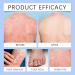  WJnflQN Soothing Skin Mist | 50ml Moisturizing Face Mist Sensitive Skin | Refreshing Facial Care Redness Oily Dry | Daily After Sun Sport Travel - Buy Online on GoSupps.com