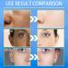 Dark Spot Remover Night Cream Anti Wrinkle Face Moisturiser Dark Spot Corrector For Face&Body Face Care Cream For Hydrating Firming Tightening Skin Face Cream For Women and Men - Buy Online on GoSupps.com