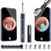 Bebird Pro Note5 Ear Wax Removal Tool Camera  Bebird Ear Cleaner  10 Megapixel HD Otoscope with Light  Ear Camera with Tweezers 3-in-1  Spade Ear Cleaner for iPhone  Android(Blue) Blue Note 5