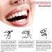 70PCS Temporary Tooth Repair Kit | False Tooth Replacement & Crowns | Front Teeth Repair | Denture & Oral Care - Buy Online on GoSupps.com