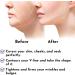 Post Surgery Chin Strap V-Shaped Face Slimmer for Double Chin Reduction - S/M Beige - Buy Online on GoSupps.com