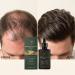 Solution paississante pour cheveux soin du cuir chevelu non gras follicule avec formule l g re produit de croissance des cheveux avec formule nourrissante aide au toilettage personnel femmes - Buy Online on GoSupps.com