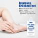 60% Urea Cream Foot Cream Cracked Heel Repair Cream For Feet and Hands Callus Remover For Dry And Hard Skin Urea Cream for Hand Foot Body Care 150g - Buy Online on GoSupps.com