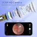 Ear Wax Removal Tool with 1920P HD Camera & LED Lights - Ear Cleaner for iPhone, iPad, Android - Earwax Remover Kit - Buy Online on GoSupps.com