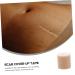 Silicone Adhesive Scar Tape 33x5.5cm | Skin Color | Medical Grade | Supple & Smooth | Gel Patch for Scars - Buy Online on GoSupps.com