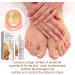 Cuticle Remover Cream Nail Cuticle Remover Gel Cuticle Oil for Nails Cuticle Care Gel Cuticle Remover Liquid Nail Treatments Cuticle Softener and Remover Nail Oil Cuticle Pen Instant Cuticle Remover - Buy Online on GoSupps.com