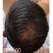 Biotin Hair Growth Conditioner 33.8oz - High Potency Anti-Hair Loss Formula with Vitamins E, A, and C for Fastest Results - Buy Online on GoSupps.com